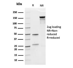 SDS-PAGE - Anti-EPO Antibody [rEPO/1367] (A248441) - Antibodies.com