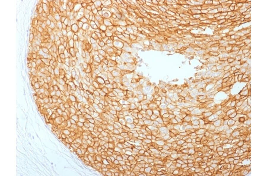 Immunohistochemistry - Anti-HER2 Antibody [ERBB2/2453] (A248445) - Antibodies.com