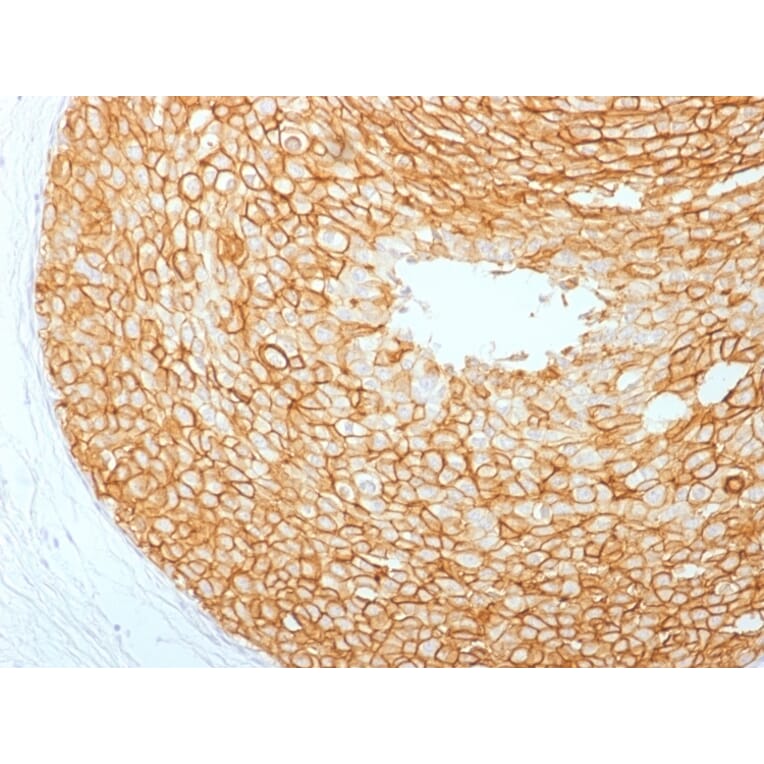 Immunohistochemistry - Anti-HER2 Antibody [ERBB2/2453] (A248445) - Antibodies.com
