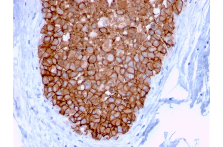 Immunohistochemistry - Anti-HER2 Antibody [ERBB2/3078] (A248446) - Antibodies.com