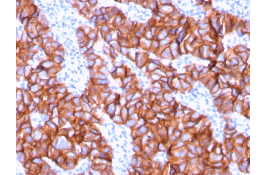 Immunohistochemistry - Anti-HER2 Antibody [ERBB2/3078] (A248446) - Antibodies.com