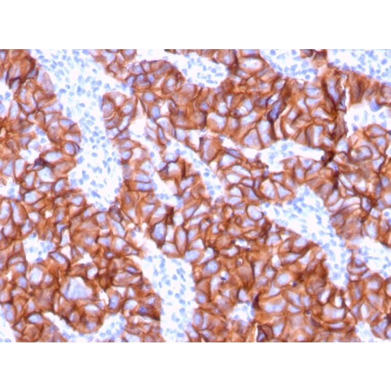 Immunohistochemistry - Anti-HER2 Antibody [ERBB2/3078] (A248446) - Antibodies.com