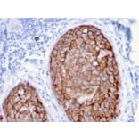 Immunohistochemistry - Anti-HER2 Antibody [ERBB2/3079] (A248447) - Antibodies.com