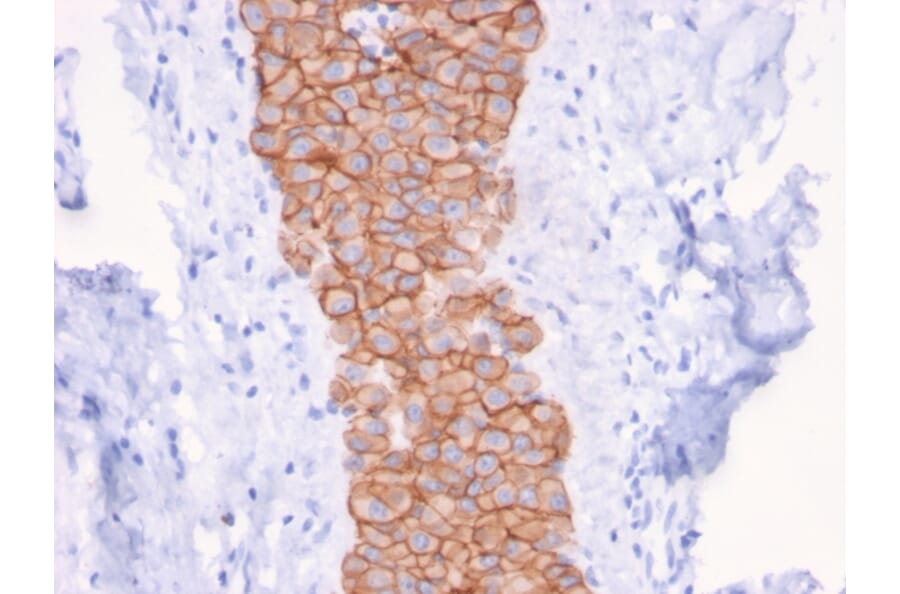 Immunohistochemistry - Anti-HER2 Antibody [ERBB2/3079] (A248447) - Antibodies.com