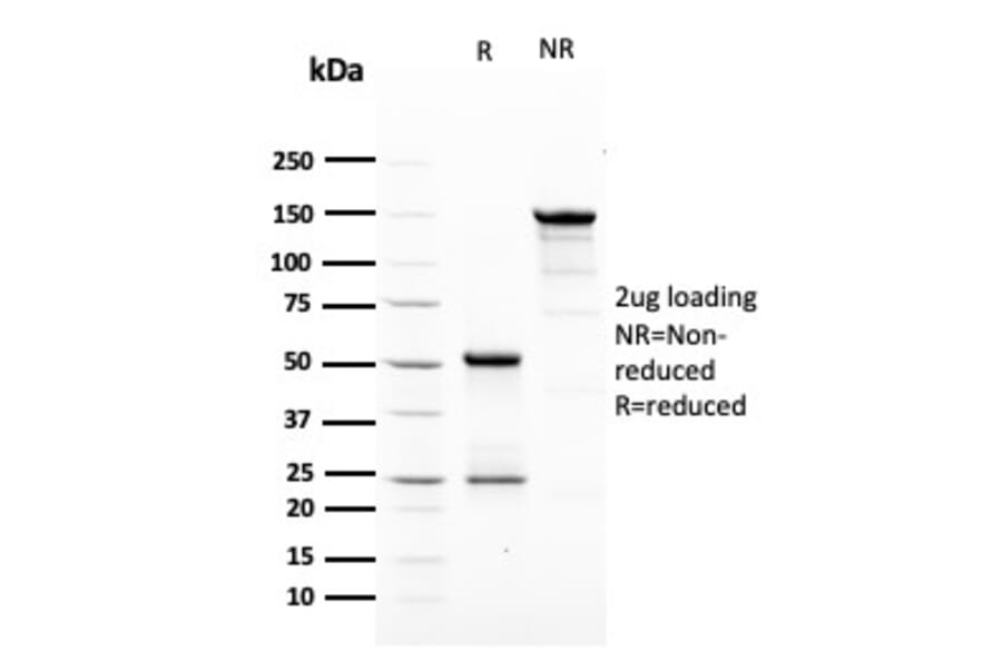 SDS-PAGE - Anti-HER2 Antibody [ERBB2/3079] (A248447) - Antibodies.com