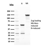 SDS-PAGE - Anti-HER2 Antibody [ERBB2/3079] (A248447) - Antibodies.com