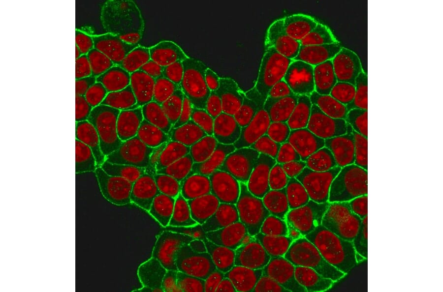 Immunofluorescence - Anti-HER2 Antibody [HRB2/451] (A248448) - Antibodies.com