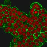 Immunofluorescence - Anti-HER2 Antibody [HRB2/451] (A248448) - Antibodies.com