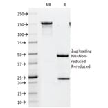 SDS-PAGE - Anti-HER2 Antibody [HRB2/451] (A248448) - Antibodies.com