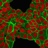 Immunofluorescence - Anti-HER2 Antibody [HRB2/451] (A248448) - Antibodies.com
