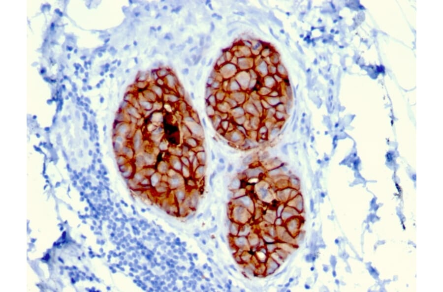 Immunohistochemistry - Anti-HER2 Antibody [ERBB2/3080] (A248449) - Antibodies.com