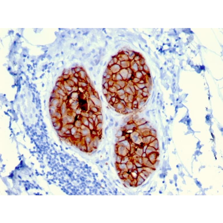 Immunohistochemistry - Anti-HER2 Antibody [ERBB2/3080] (A248449) - Antibodies.com