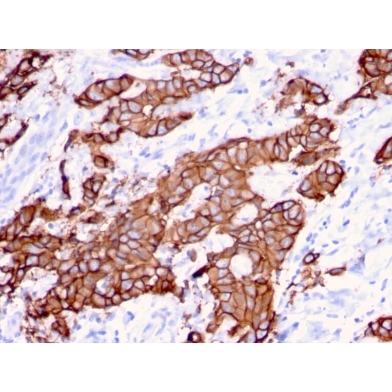 Immunohistochemistry - Anti-HER2 Antibody [ERBB2/3080] (A248449) - Antibodies.com