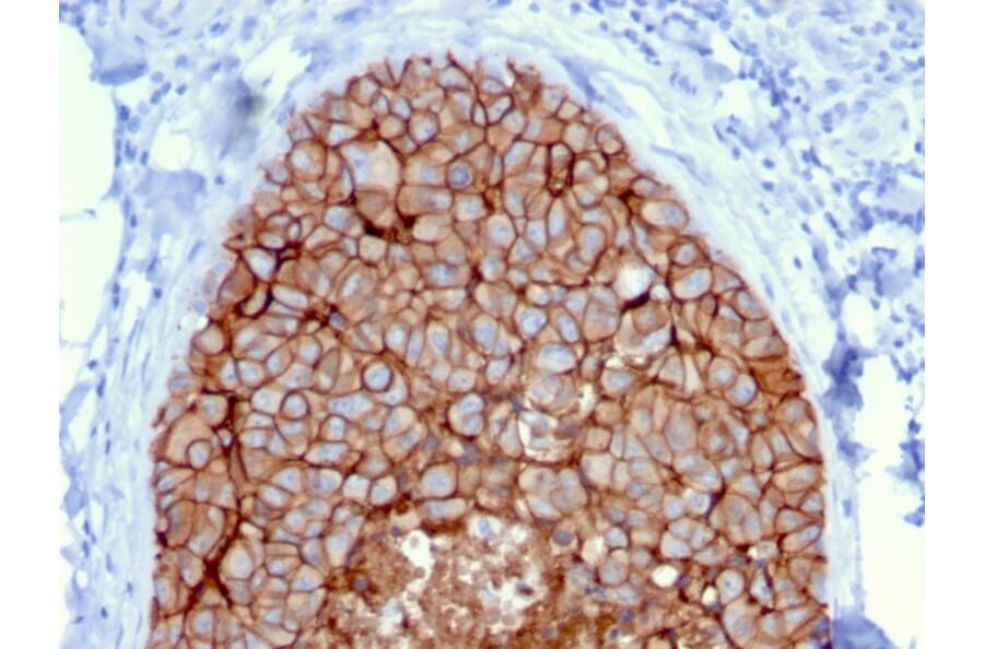 Immunohistochemistry - Anti-HER2 Antibody [ERBB2/3080] (A248449) - Antibodies.com