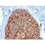 Immunohistochemistry - Anti-HER2 Antibody [ERBB2/3080] (A248449) - Antibodies.com