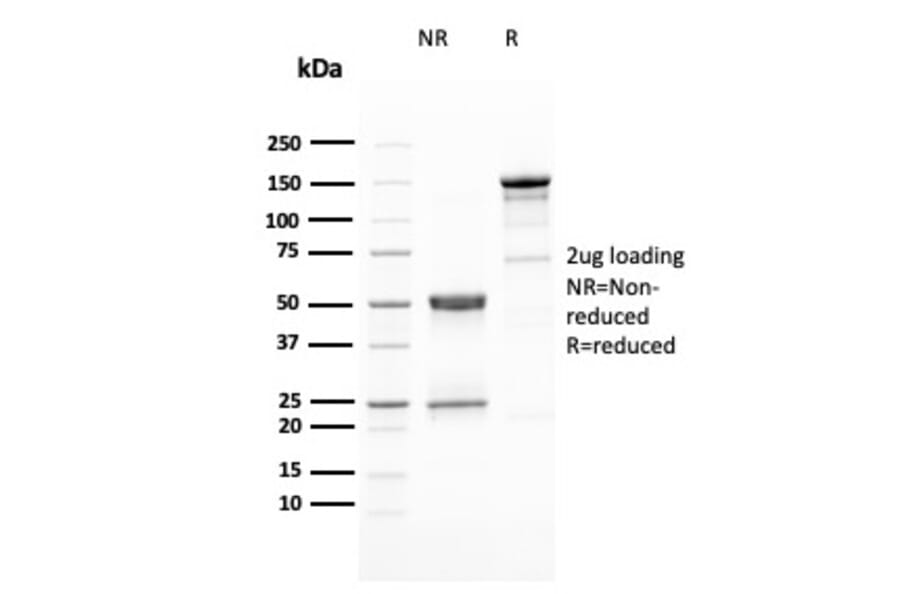 SDS-PAGE - Anti-HER2 Antibody [ERBB2/3080] (A248449) - Antibodies.com