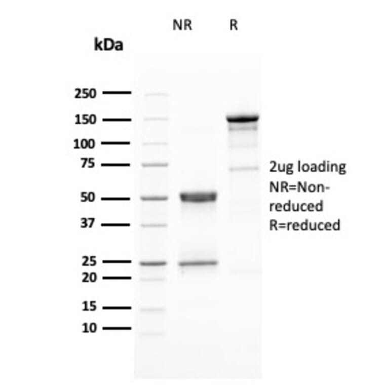 SDS-PAGE - Anti-HER2 Antibody [ERBB2/3080] (A248449) - Antibodies.com