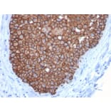 Immunohistochemistry - Anti-HER2 Antibody [ERBB2/3092] (A248450) - Antibodies.com