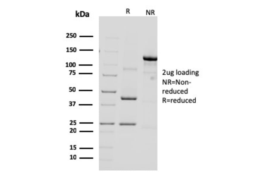SDS-PAGE - Anti-HER2 Antibody [ERBB2/3092] (A248450) - Antibodies.com