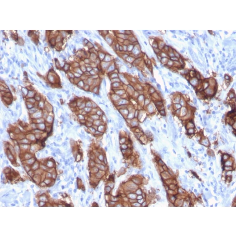 Immunohistochemistry - Anti-HER2 Antibody [ERBB2/3093] (A248451) - Antibodies.com