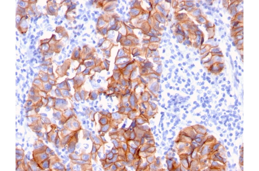 Immunohistochemistry - Anti-HER2 Antibody [ERBB2/3093] (A248451) - Antibodies.com