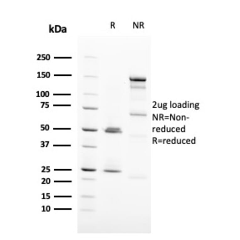 SDS-PAGE - Anti-HER2 Antibody [ERBB2/3093] (A248451) - Antibodies.com