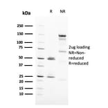 SDS-PAGE - Anti-HER2 Antibody [ERBB2/3093] (A248451) - Antibodies.com