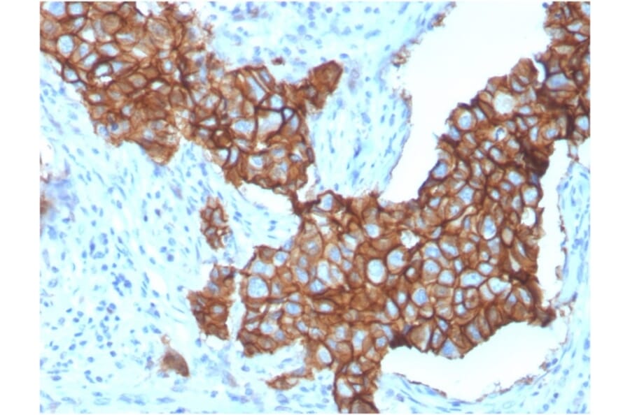Immunohistochemistry - Anti-HER2 Antibody [ERBB2/3257] (A248452) - Antibodies.com