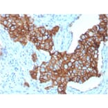 Immunohistochemistry - Anti-HER2 Antibody [ERBB2/3257] (A248452) - Antibodies.com