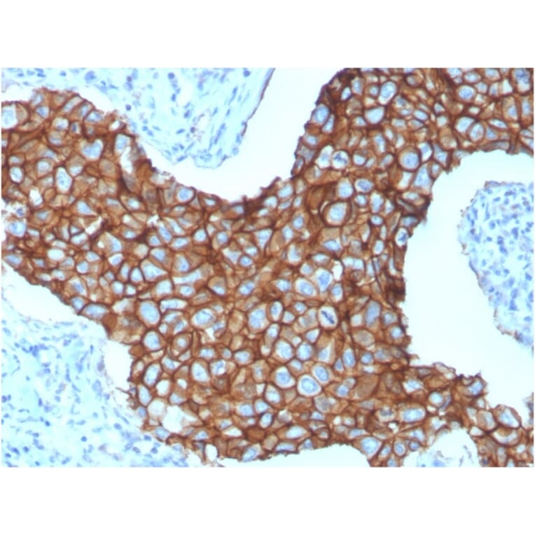 Immunohistochemistry - Anti-HER2 Antibody [ERBB2/3257] (A248452) - Antibodies.com