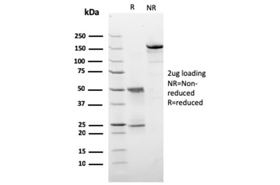SDS-PAGE - Anti-HER2 Antibody [ERBB2/3257] (A248452) - Antibodies.com