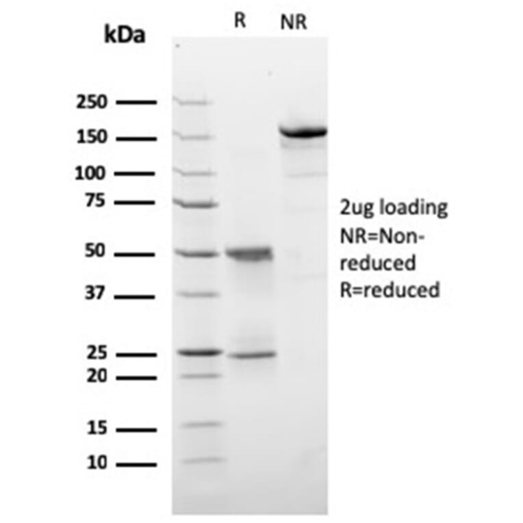 SDS-PAGE - Anti-HER2 Antibody [ERBB2/3257] (A248452) - Antibodies.com