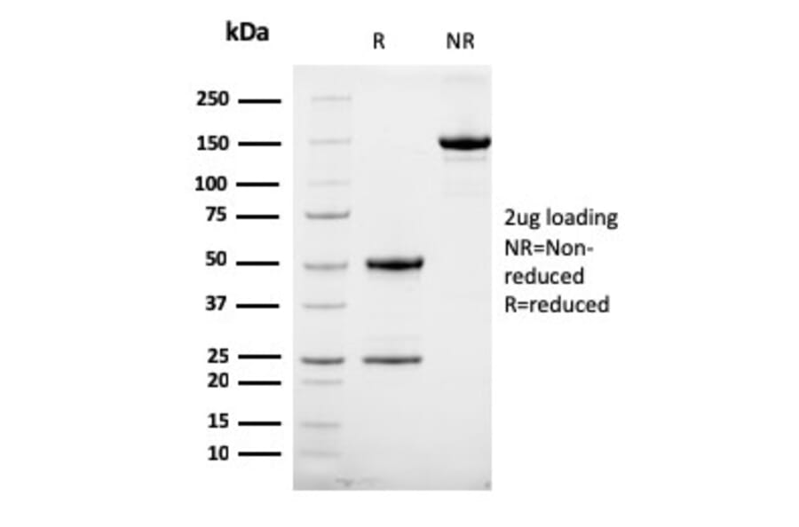 SDS-PAGE - Anti-HER2 Antibody [HRB2/258] (A248452) - Antibodies.com