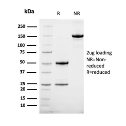 SDS-PAGE - Anti-HER2 Antibody [HRB2/258] (A248452) - Antibodies.com