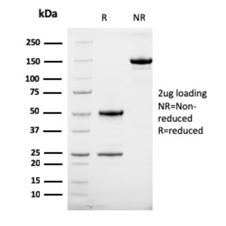 SDS-PAGE - Anti-HER2 Antibody [HRB2/258] (A248452) - Antibodies.com