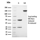 SDS-PAGE - Anti-HER2 Antibody [HRB2/258] (A248452) - Antibodies.com