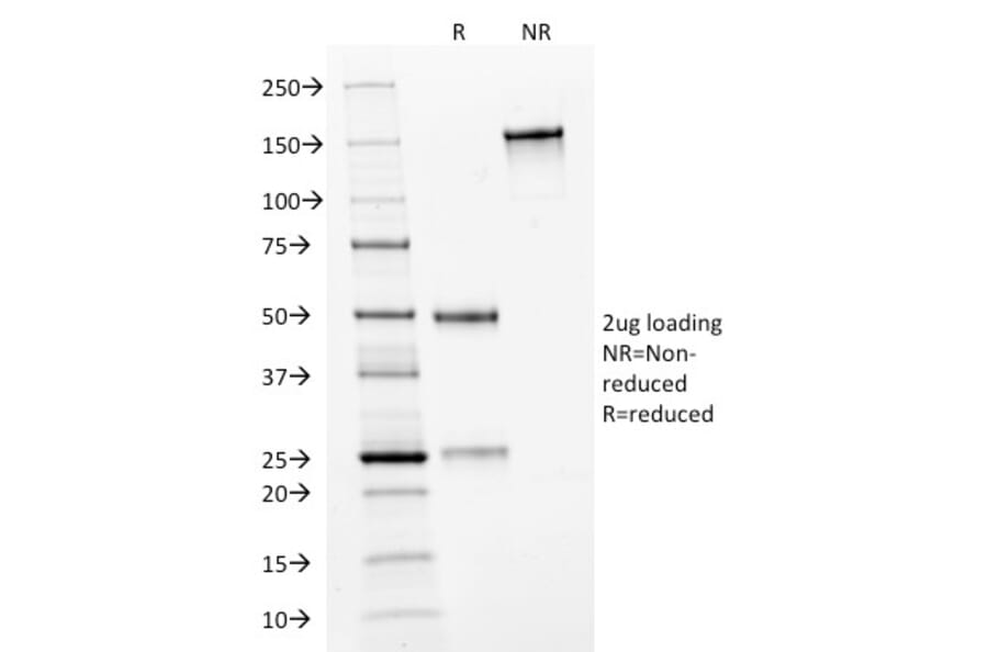 SDS-PAGE - Anti-HER2 Antibody [HRB2/282] (A248454) - Antibodies.com