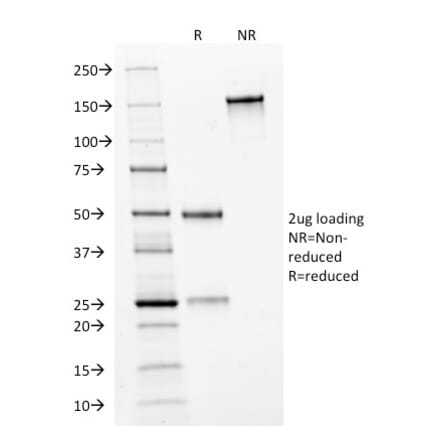 SDS-PAGE - Anti-HER2 Antibody [HRB2/282] (A248454) - Antibodies.com