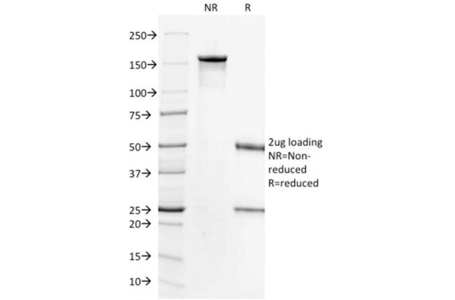 SDS-PAGE - Anti-HER2 Antibody [HRB2/718] (A248455) - Antibodies.com