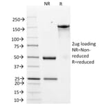 SDS-PAGE - Anti-HER2 Antibody [ERB2/776] (A248456) - Antibodies.com