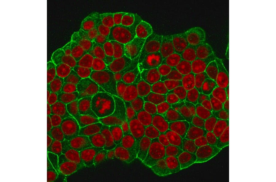 Immunofluorescence - Anti-HER2 Antibody [ERB2/776] (A248456) - Antibodies.com