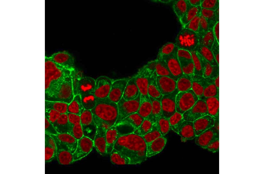 Immunofluorescence - Anti-HER2 Antibody [ERB2/776] (A248456) - Antibodies.com