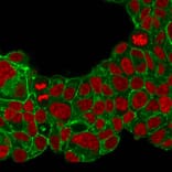 Immunofluorescence - Anti-HER2 Antibody [ERB2/776] (A248456) - Antibodies.com