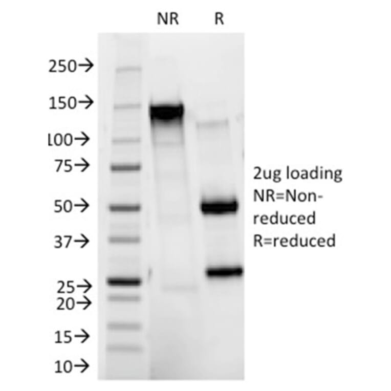 SDS-PAGE - Anti-HER2 Antibody [HRB2/273] (A248457) - Antibodies.com