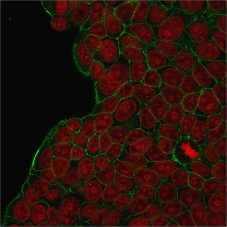 Immunofluorescence - Anti-HER2 Antibody [HRB2/273] (A248456) - Antibodies.com