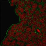 Immunofluorescence - Anti-HER2 Antibody [HRB2/273] (A248456) - Antibodies.com