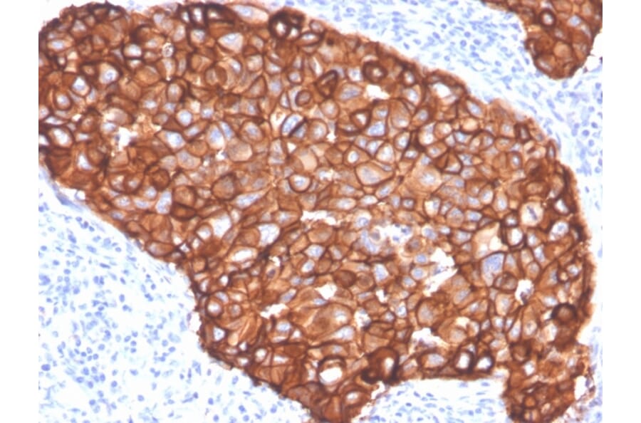 Immunohistochemistry - Anti-HER2 Antibody [ZR5] (A248458) - Antibodies.com