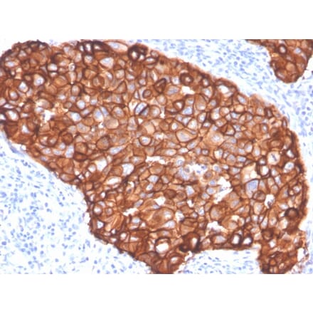 Immunohistochemistry - Anti-HER2 Antibody [ZR5] (A248458) - Antibodies.com