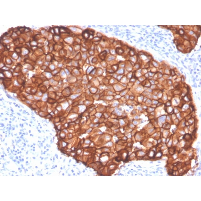 Immunohistochemistry - Anti-HER2 Antibody [ZR5] (A248458) - Antibodies.com