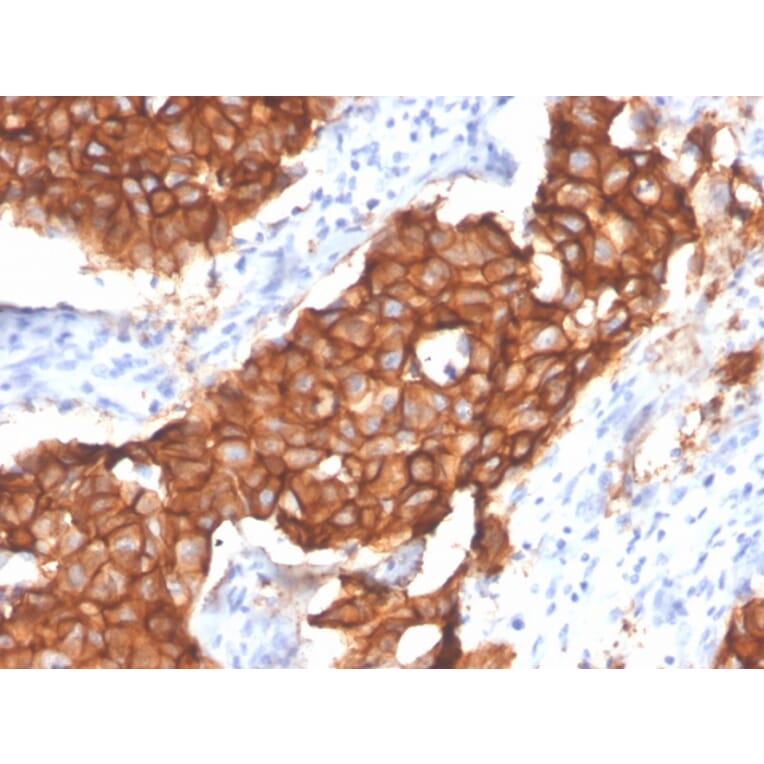 Immunohistochemistry - Anti-HER2 Antibody [ERBB2/4439] (A248459) - Antibodies.com
